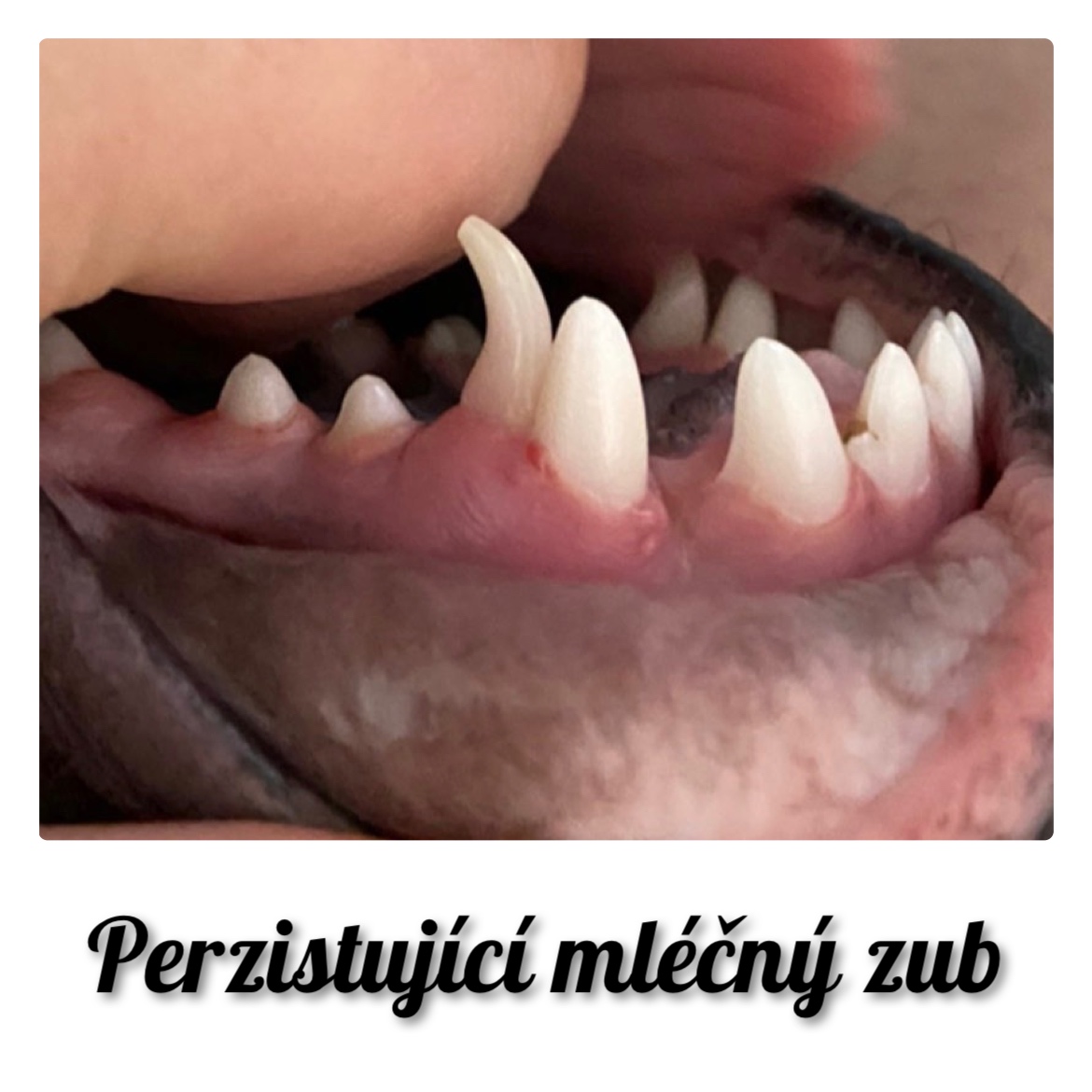 Perzistující zuby